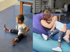 Imagem - Menino de 1 ano com mãos e pés amputados ganha próteses após pai desviar R$ 113 mil de campanha