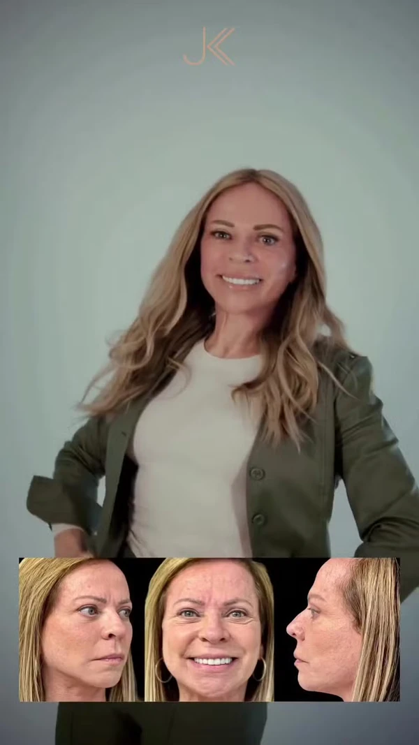 Christina Rocha aparece com 'novo rosto' após procedimento estético por  Reprodução/Instagram/JK Estética