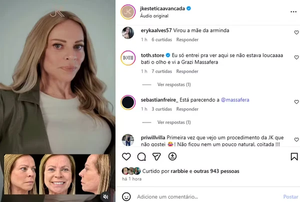 Christina Rocha aparece com 'novo rosto' após procedimento estético por  Reprodução/Instagram/JK Estética