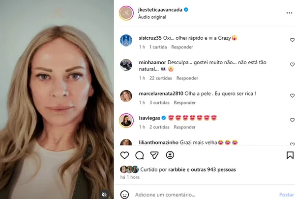 Christina Rocha aparece com 'novo rosto' após procedimento estético por  Reprodução/Instagram/JK Estética