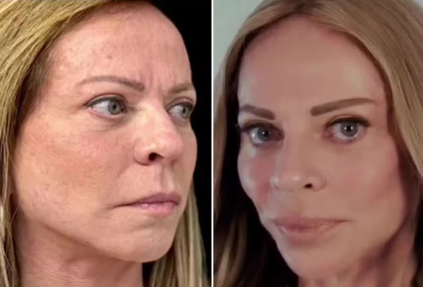 Christina Rocha aparece com 'novo rosto' após procedimento estético por  Reprodução/Instagram/JK Estética