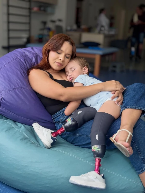 Noah recebeu uma doação de prótese por Reprodução/ Redes sociais