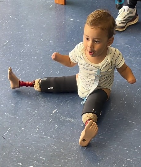 Noah recebeu uma doação de prótese por Reprodução/ Redes sociais