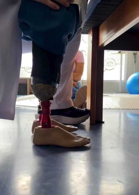 Noah recebeu uma doação de prótese por Reprodução/ Redes sociais