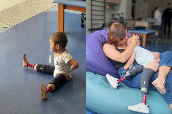 Noah recebeu uma doação de prótese