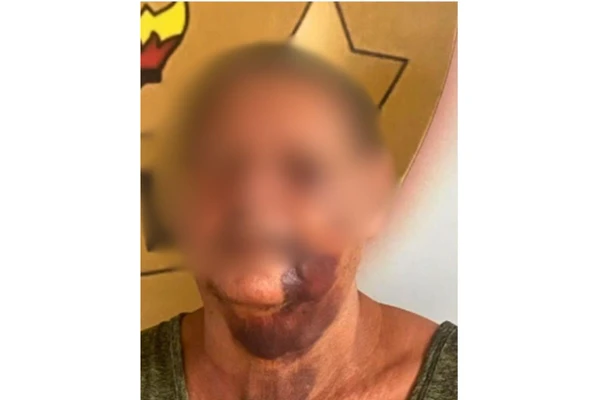 Casal de idosos foi espancado por motoristas após alerta por Reprodução