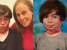 Imagem - Morre neto de Deborah Colker, inspiração para o espetáculo "Cura"