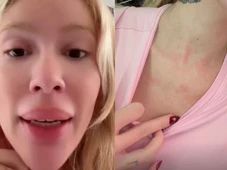 Imagem - Karoline Lima surge com olhos inchados e preocupa fãs: ‘Chorei muito’