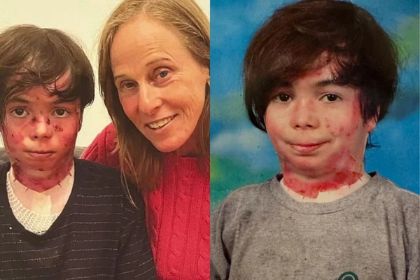 Falece Theo Colker, neto de Deborah Colker, aos 14 anos