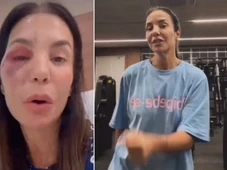 Imagem - Ivete Sangalo é liberada para voltar aos treinos após cirurgia no rosto: 'Agora estou pronta'