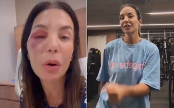 Ivete Sangalo no hospital após a queda e atualmente, na academia