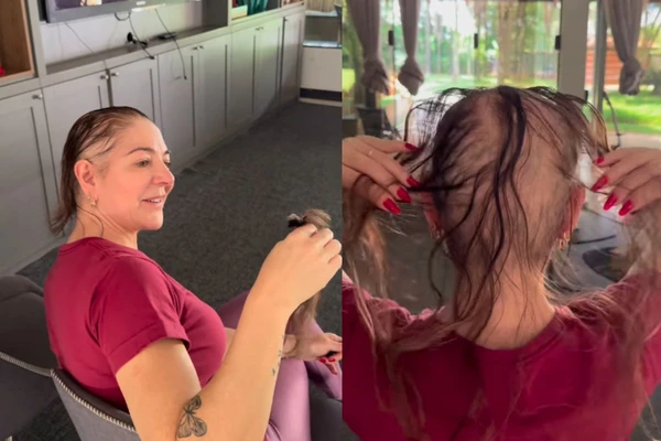 Karina Lucco abriu mão dos cabelos durante tratamento