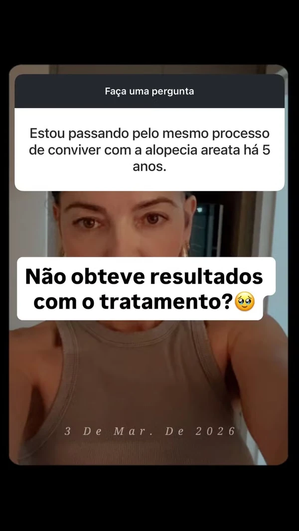 Mãe de Lucas Lucco mostra cabelo após diagnóstico de alopecia por Reprodução/Redes Sociais 