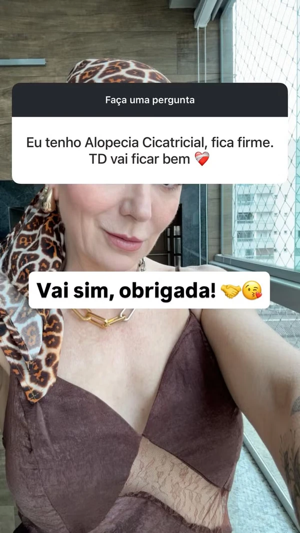 Mãe de Lucas Lucco mostra cabelo após diagnóstico de alopecia por Reprodução/Redes Sociais 