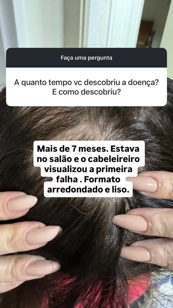 Mãe de Lucas Lucco mostra cabelo após diagnóstico de alopecia por Reprodução/Redes Sociais 