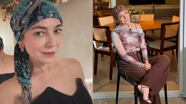 Mãe de Lucas Lucco mostra cabelo após diagnóstico de alopecia por Reprodução/Redes Sociais 