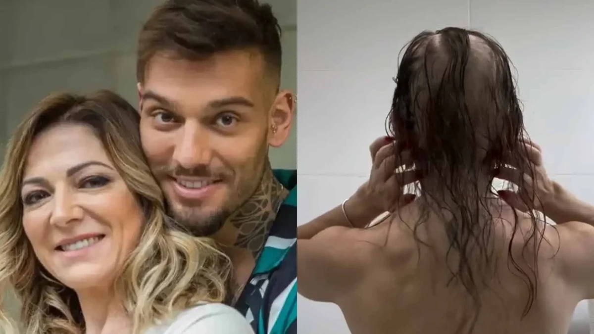 Mãe de Lucas Lucco mostra cabelo após diagnóstico de alopecia