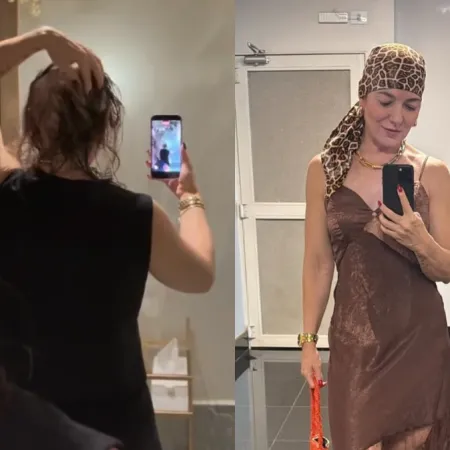 Mãe de Lucas Lucco mostra cabelo após diagnóstico de alopecia por Reprodução/Redes Sociais 