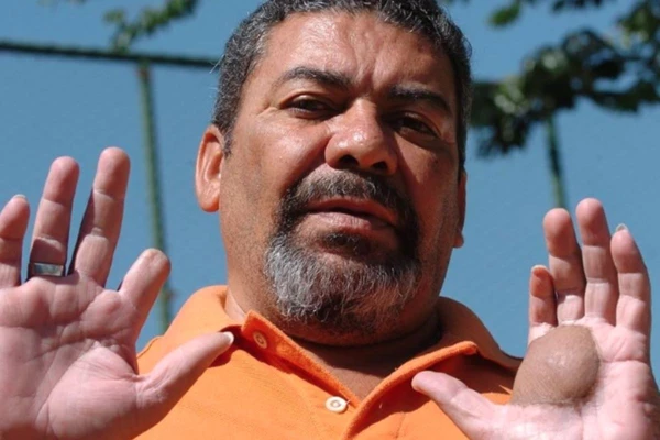 Material radioativo causou vários problemas