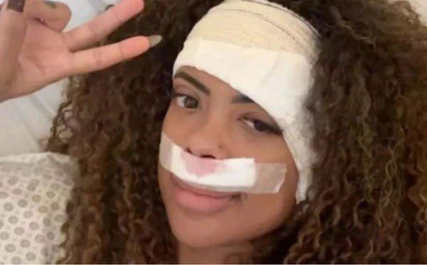 Marvvila passa por cirurgia e se recupera bem