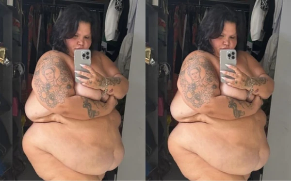 Thais Carla mostra antes e depois da bariátrica