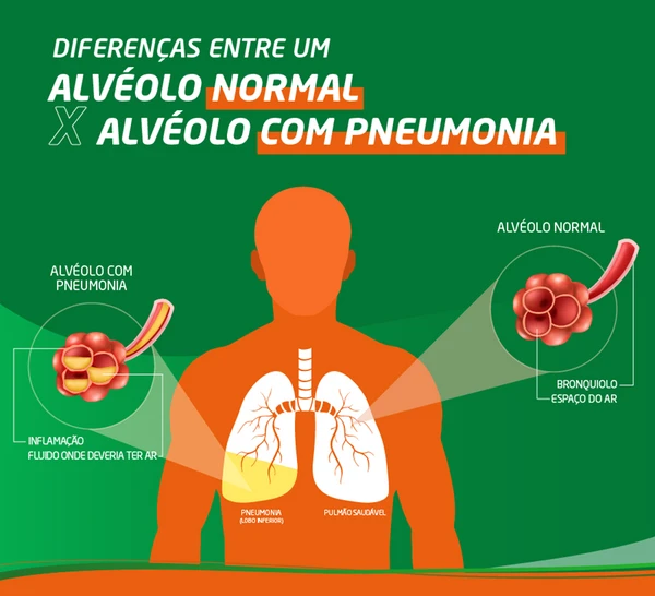 Pneumonia por Reprodução