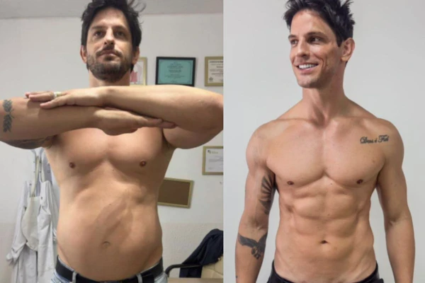 Modelo impressinou com mudança