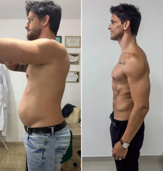 Antes e depois de Miro Moreira