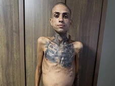 Imagem - Jota Surfista morreu de quê? Veja sintomas, fatores de risco e como prevenir as duas doenças