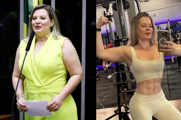 Antes e depois de Joice Hasselmann