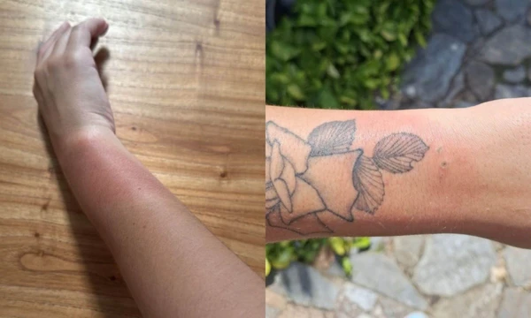 Fãs relatam queimaduras na pele após uso de pulseiras em show de Luan Santana em BH por Reprodução/Redes Sociais 