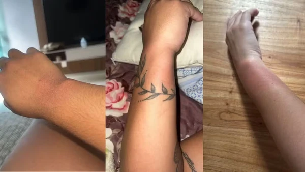 Fãs relatam queimaduras na pele após uso de pulseiras em show de Luan Santana em BH por Reprodução/Redes Sociais 