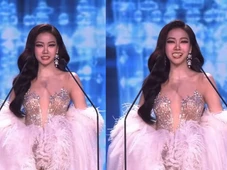 Imagem - 'Não deixou a coroa cair': Candidata a Miss perde prótese dentária durante discurso e reação surpreende internautas