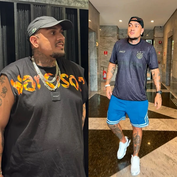 MC Binn: antes e depois por Reprodução/Instagram