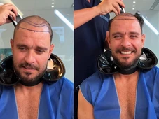 Imagem - Diogo Nogueira aparece com cabelo raspado e web suspeita de transplante capilar