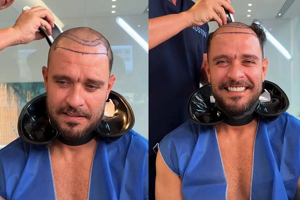 Diogo Nogueira aparece raspando cabelo em nova publicação nas redes sociais