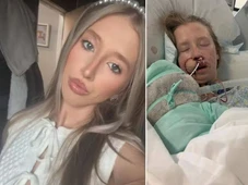 Imagem - Jovem fica desfigurada após ataque de cão que ela convivia desde filhote: 'Só lembro dele indo direto no meu rosto'