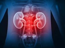 Imagem - Combinação comum de remédios pode levar à insuficiência renal aguda