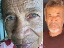 Imagem - Medicamento usado em mutirão que deixou pacientes cegos na Bahia é indicado para câncer e não para os olhos