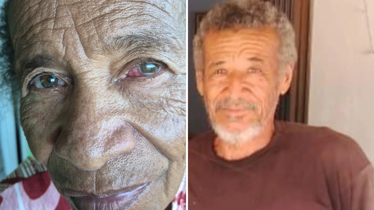 Cleuza (esquerda) perdeu a visão permanentemente após o mutirão; Gilberto morreu um mês após o procedimento (direita)