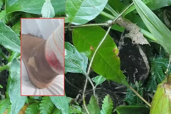 Homem denunciou negligência médica por Reprodução