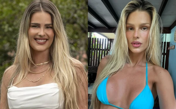 Yasmin Brunet: antes e depois por  João Cotta/Rede Globo e Reprodução/Instagram