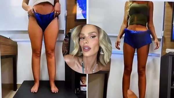 Yasmin Brunet mostrou antes e depois após perder 25kg por Reprodução/Instagram