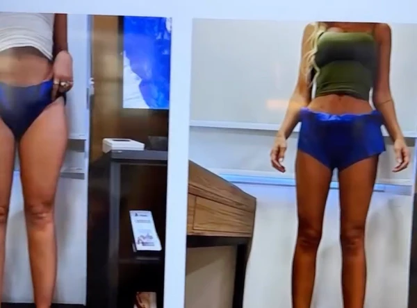 Yasmin Brunet mostrou antes e depois após perder 25kg por Reprodução/Instagram