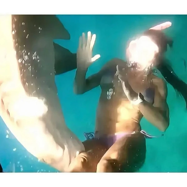 Advogada foi mordida por tubarão e ficou com cicatriz na perna