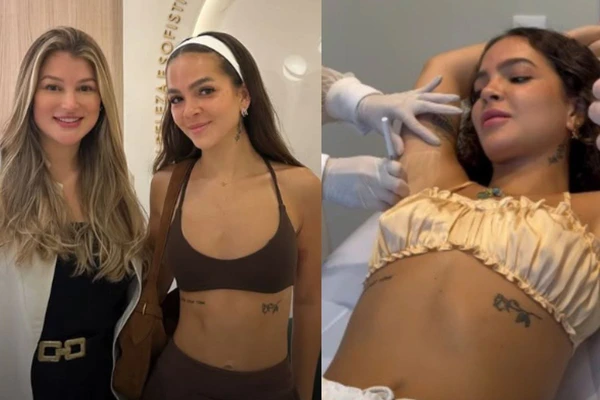 Mel Maia retocou procedimento realizado em setembro do ano passado