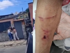 Imagem - Estagiária de posto de saúde é desligada de prefeitura baiana após agredir idosa