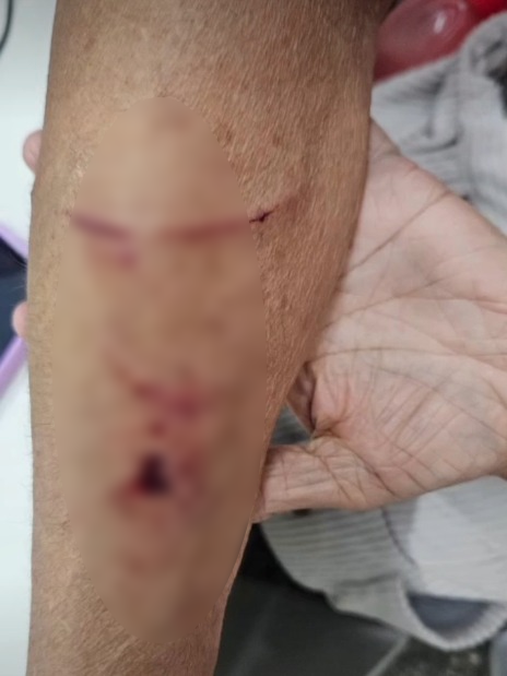 Estagiária de UBS  foi desligada de prefeitura baiana após bater em idosa por Reprodução/ Redes sociais