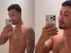 Imagem - Carlinhos Maia reaparece nas redes sociais e revela resultado de procedimento estético