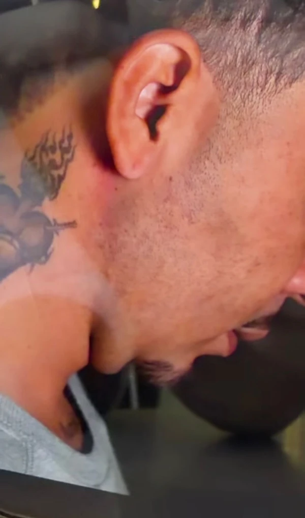 Carlinhos Maia antes do procedimento na região da papada por Reprodução/Instagram